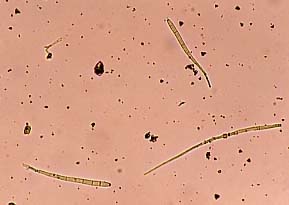 cercospora1.jpg