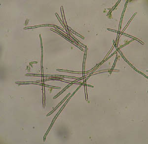 pseudocercospora.jpg