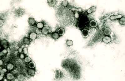 tospovirus.jpg