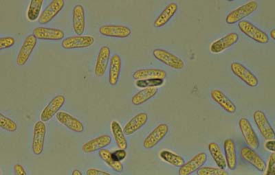 colletotrichum1.jpg