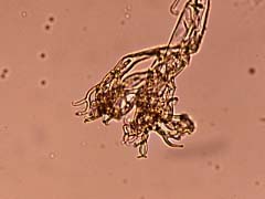 peronospora.jpg