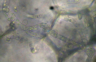 pythium1.jpg